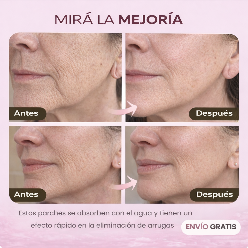 Tratamiento Naturaful™