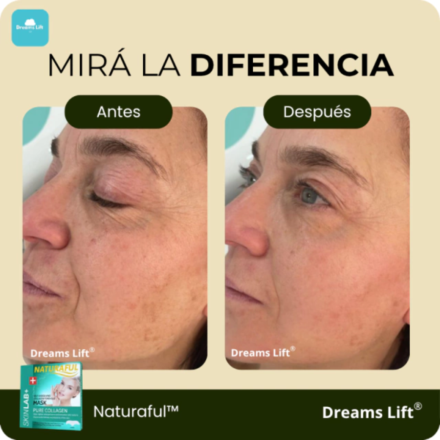 Naturaful™ | Pack Parches de colágeno hidrolizados + Rutina Skincare (GRATIS)