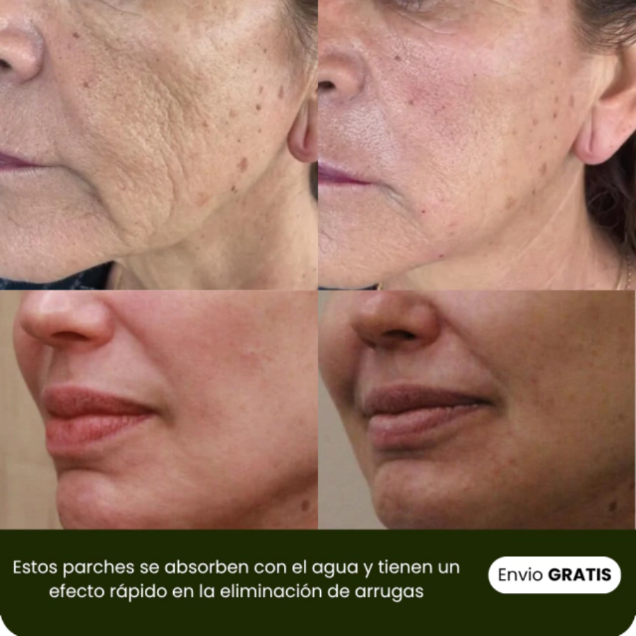 Naturaful™ | Pack Parches de colágeno hidrolizados + Rutina Skincare (GRATIS)