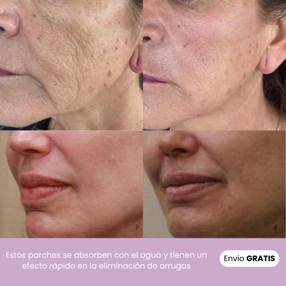 Tratamiento Naturaful™