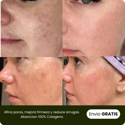 Naturaful™ | Pack Parches de colágeno hidrolizados + Rutina Skincare (GRATIS)