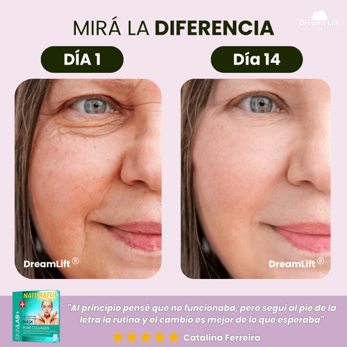 Tratamiento Naturaful™