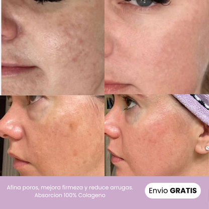 Tratamiento Naturaful™